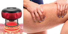 Load image into Gallery viewer, Smart Cupping Massager™