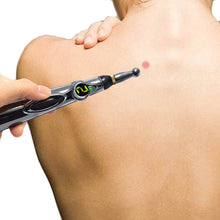 Load image into Gallery viewer, Electric Acupuncture Pen