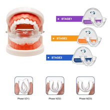 Load image into Gallery viewer, Three Stage Teeth Retainer

